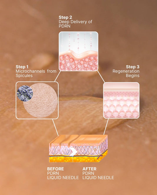 Advanced Regeneration Liquid Needling with Salmon DNA