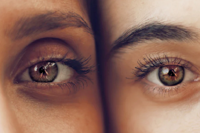 Treatments of Dark circles