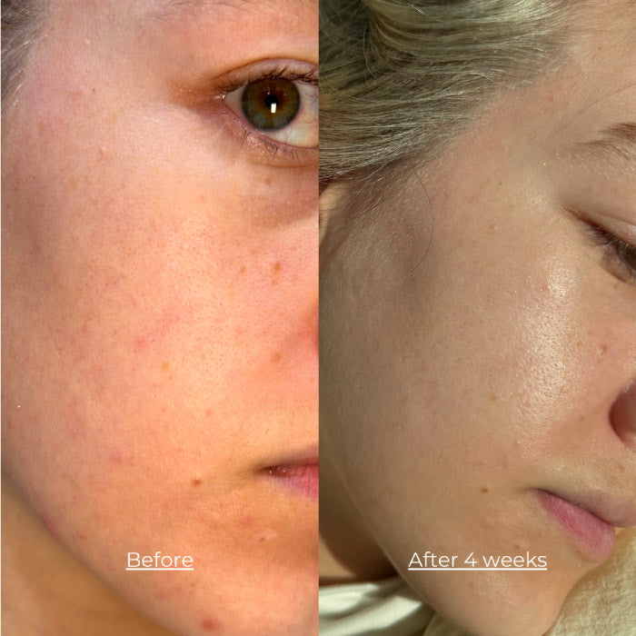 Luminous LED Light Mask