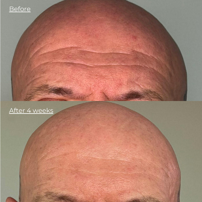Luminous LED Light Mask