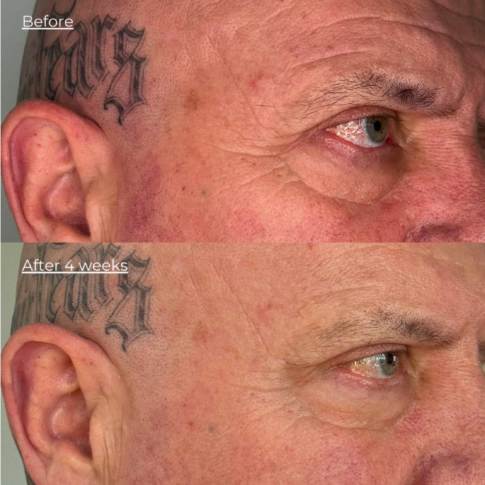 Luminous LED Light Mask