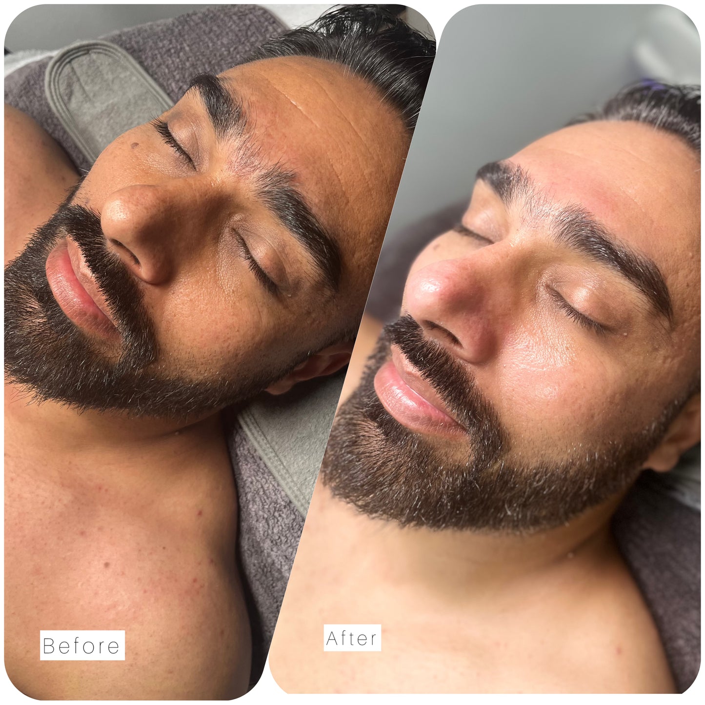 Cya Signature Custom Facial