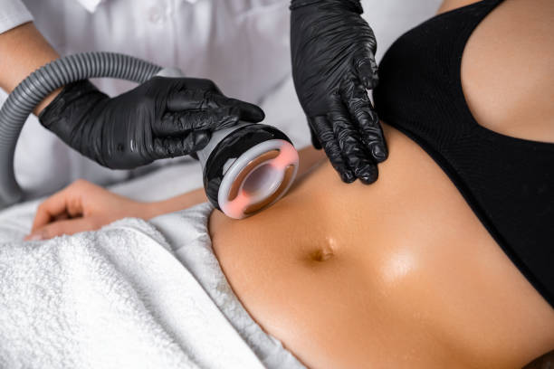 Ultrasonic Fat Cavitation Body