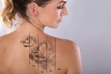 Load image into Gallery viewer, PicoSure Tattoo Removal