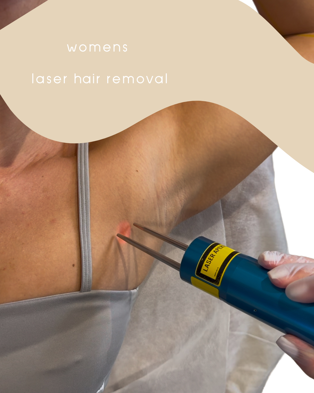 womenslaserhairremoval